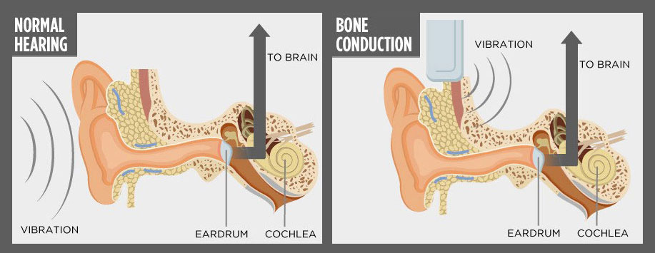 normal-hearing-vs-bone-conduction-techie